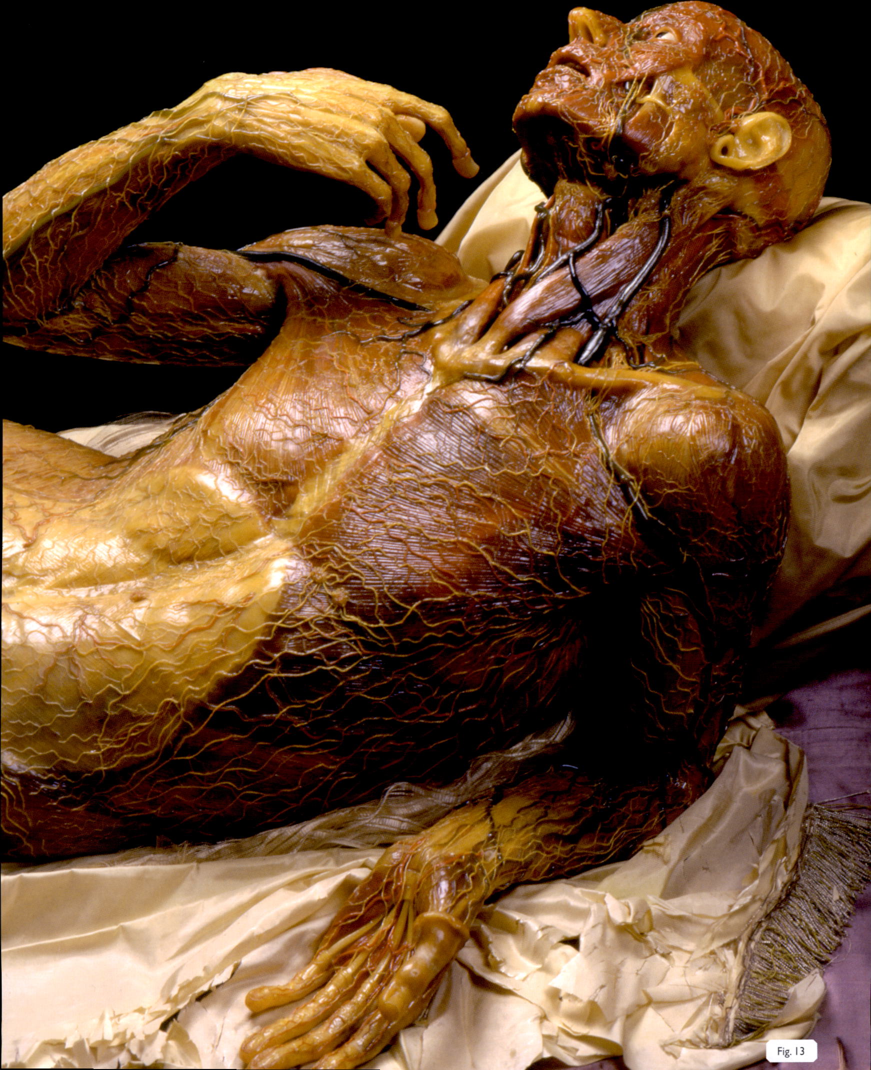 Busto de "Lo Spellato" ©La Specola, Firenze. Tratta da Barsanti G., Chelazzi G., Il Museo di Storia Naturale dell'Università degli Studi di Firenze, vol. 1 Le collezioni della Specola: zoologia e cere anatomiche, Firenze University Press, 2009.